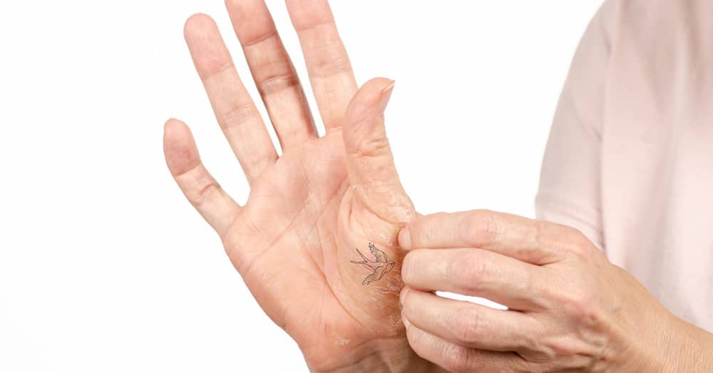 Irritation of Hand and Finger Tattoo